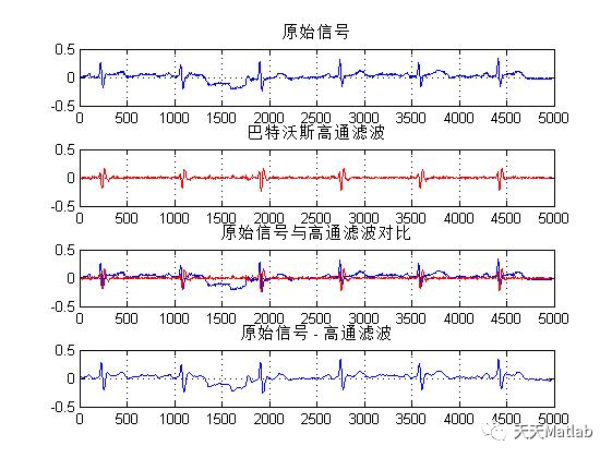 【心电信号】基于多种滤波去除心电信号基线漂移含Matlab源码_高通滤波